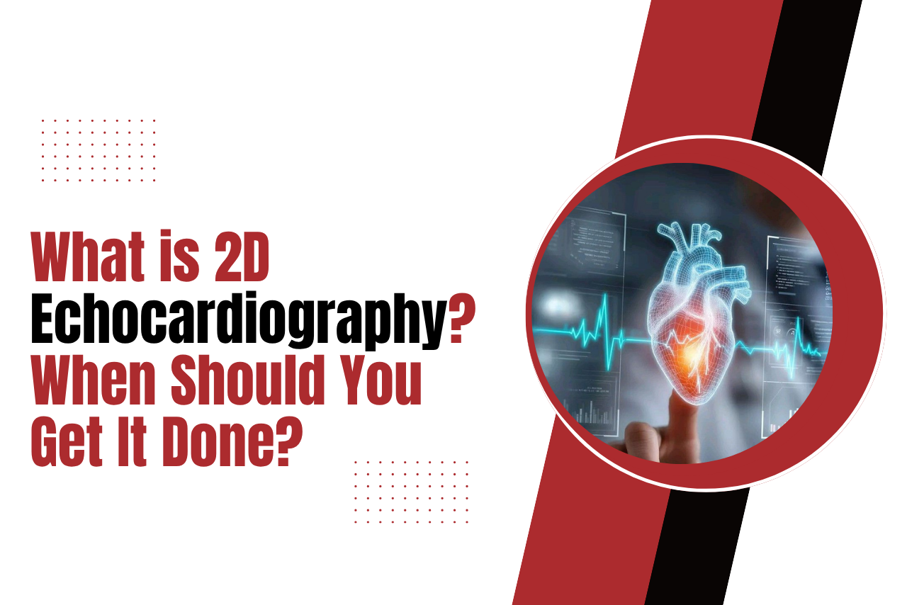 Echocardiography