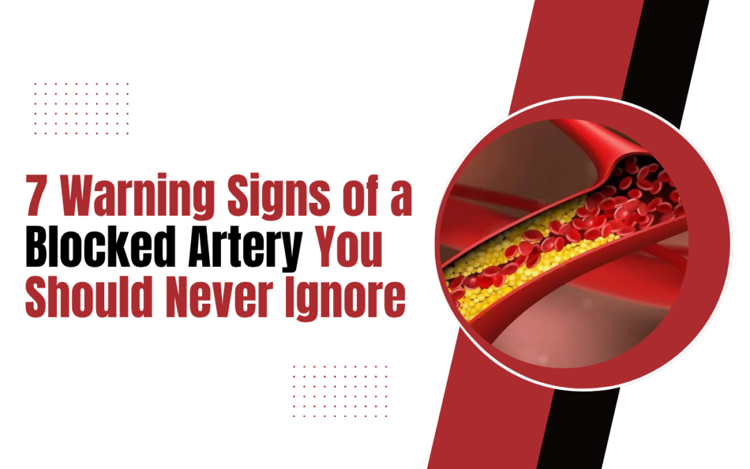 7 Warning Signs of a Blocked Artery You Should Never Ignore