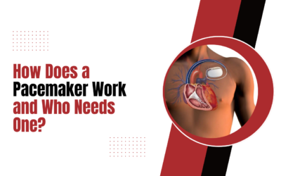 How Does a Pacemaker Work and Who Needs One?
