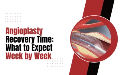 Angioplasty Recovery Time: What to Expect Week by Week